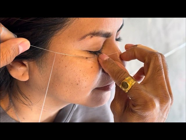 [ASMR] Threading Mole & Skin Tag Removal (Perfect Result) || Deep Sleep & Stress Relief