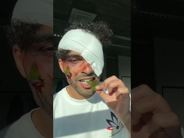 So to answer your question, it didn't hurt, but please don't try it at home.