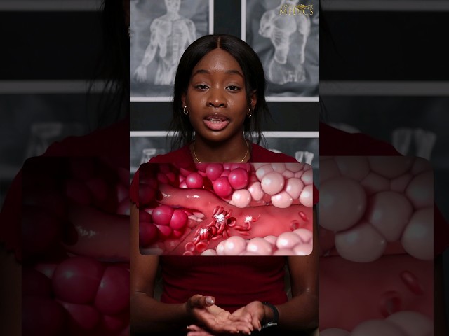 Sickle Cell Anaemia Explained and Simplified!