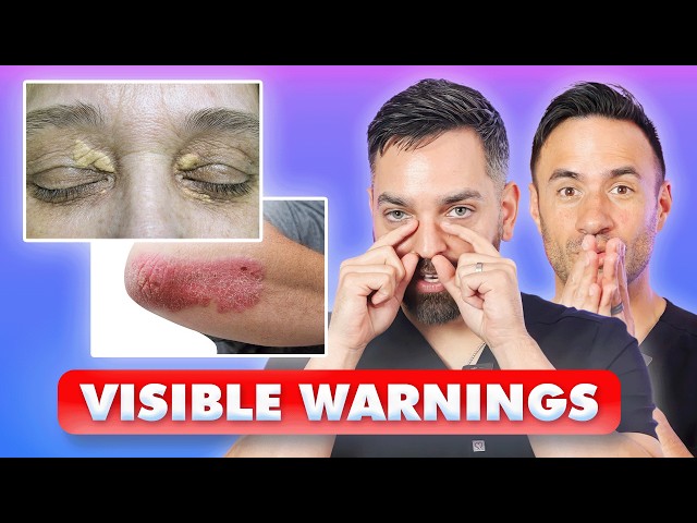 11 DANGEROUS Skin Signs You Should NEVER IGNORE | Dermatologists Explain