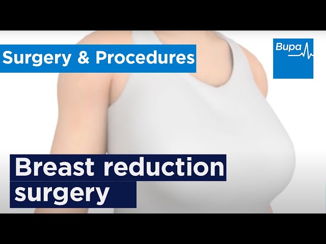 How breast reduction surgery is carried out | Bupa Health