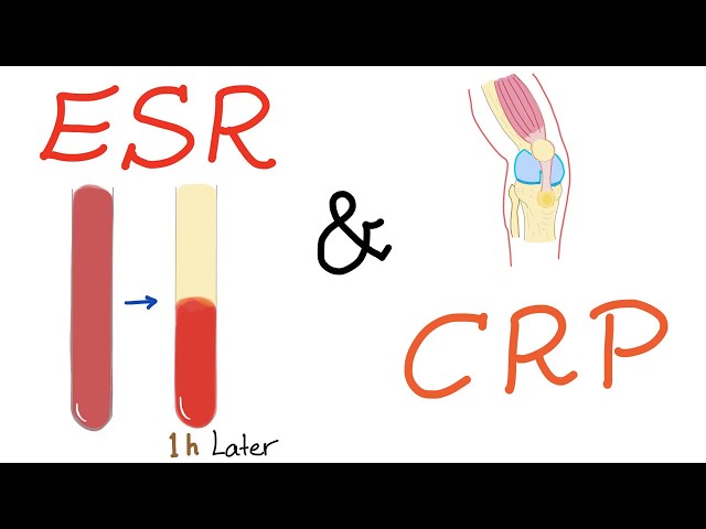 ESR and CRP