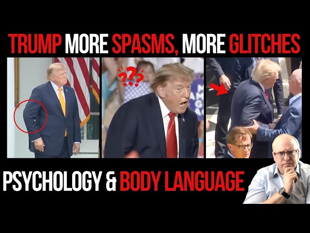 Trump’s SPASMS and Verbal GLITCHES Are Getting Worse: Psychology & Body Language