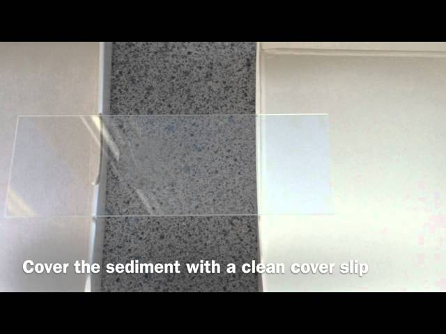 Iphone Urine Microscopy