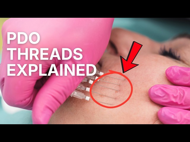 How Does PDO Thread Lift Procedure Work