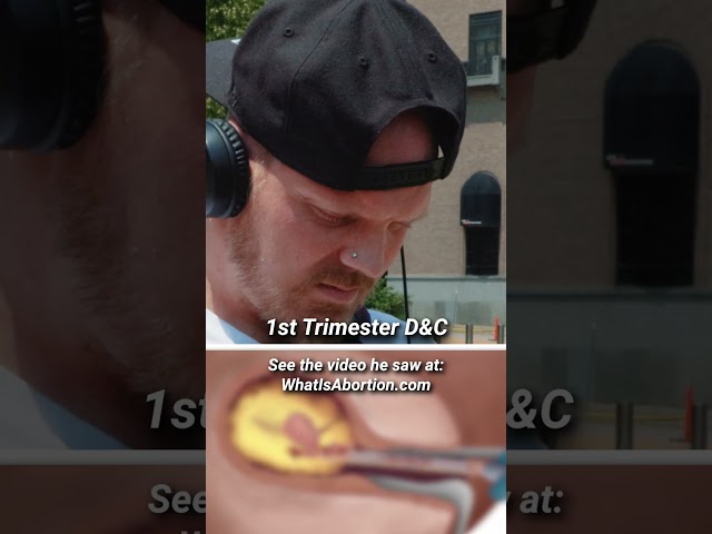 Watch His MIND CHANGE On Abortion