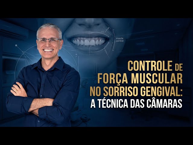 Controle de força muscular no sorriso gengival: a técnica das câmaras