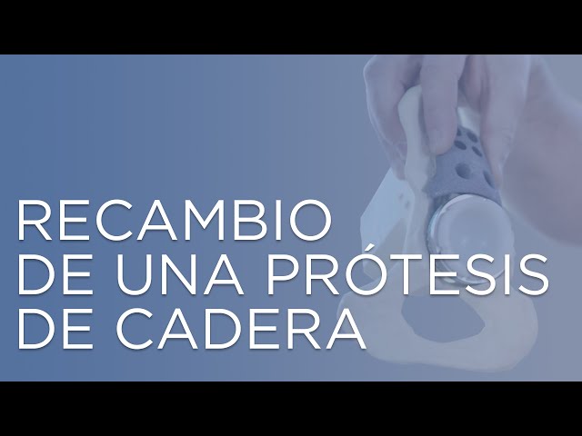 Recambio de una prótesis de cadera | ¿Por qué me tienen que cambiar la prótesis?