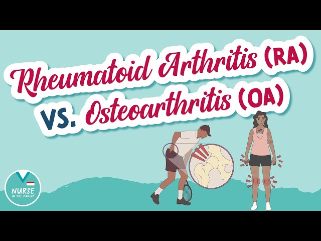 Osteoarthritis (OA) Vs. Rheumatoid Arthritis (RA) - What's the difference?