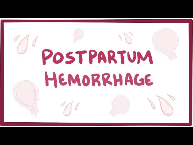 Postpartum hemorrhage - causes, symptoms, diagnosis, treatment, pathology