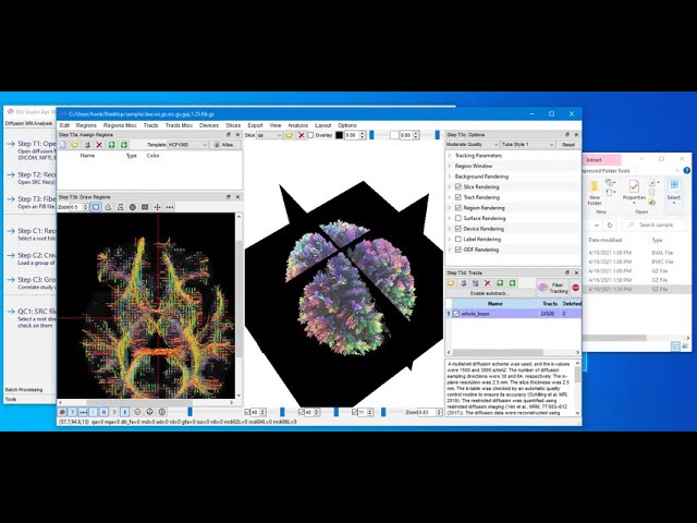 NIFTI file to Tractography in 2 minutes