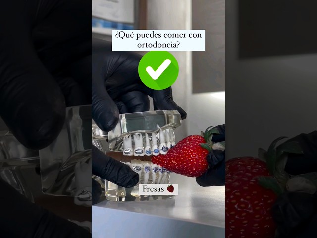 Alimentos que puedes comer con ortodoncia o #brackets #dentist #dentista #dental #dientes