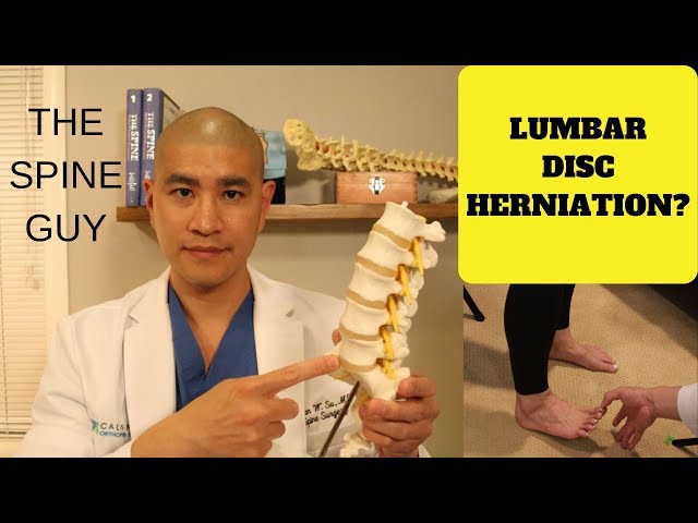 How do you know if you have a lumbar Disc Herniation?