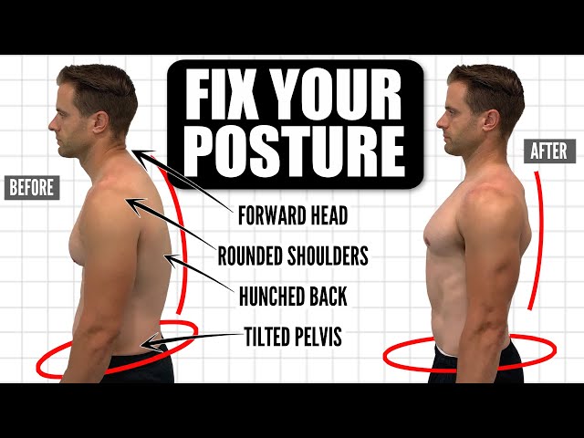 How To FIX Your Posture | 10-Minute Daily Routine