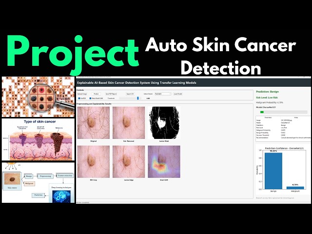 Best Skin Cancer Datasets for Machine Learning & CNN Projects