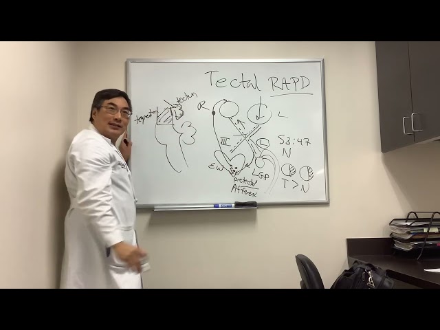 Tectal RAPD