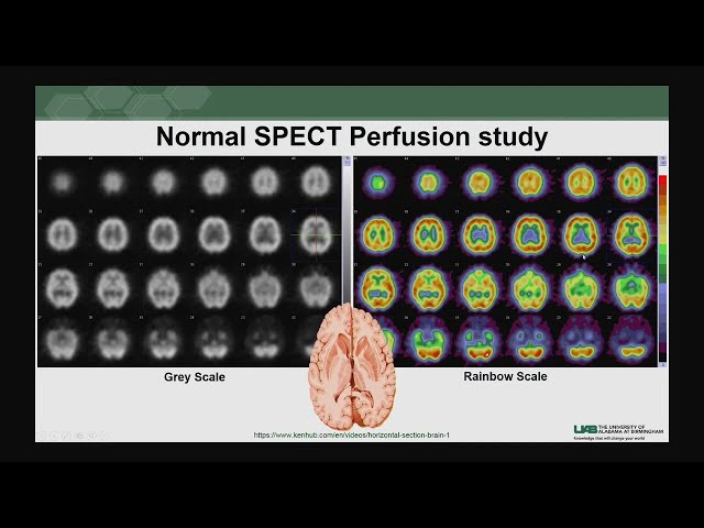 2023 Classic Lectures in Clinical Nuclear Medicine - A CME Teaching Activity