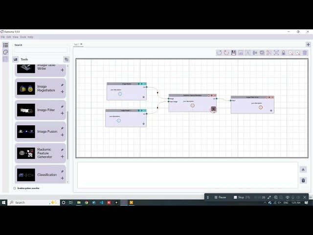 Radiomics Feature Extraction with Radiuma| Radiuma Tutorial