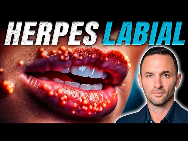 The most effective natural treatment for cold sores