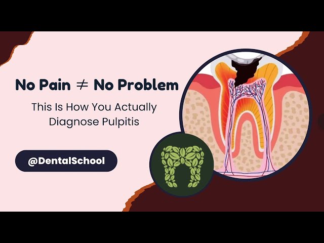 How to Diagnose Pulp Conditions – Reversible, Irreversible, or Necrosis?