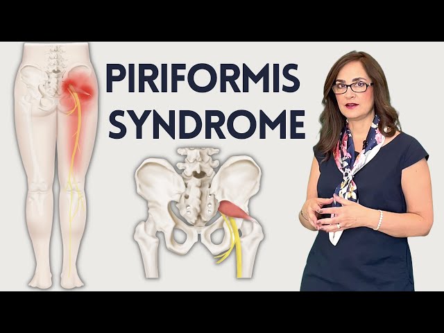 #116 How to eliminate lower back pain pain from the piriformis muscle