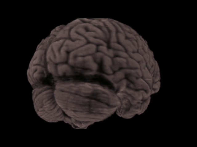 MRI Data Visualization