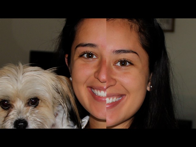 Texas Nurse Becomes The Patient After Having A Stroke At 24