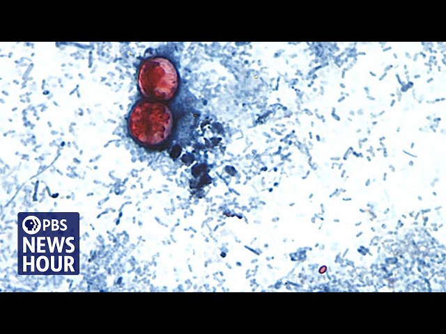 What we know about the cyclosporiasis outbreak linked to produce