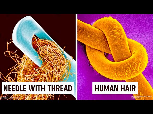 14 Amazing Things Under a Microscope You Can't Unsee