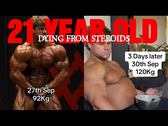 21 On Steroids And Going To Die