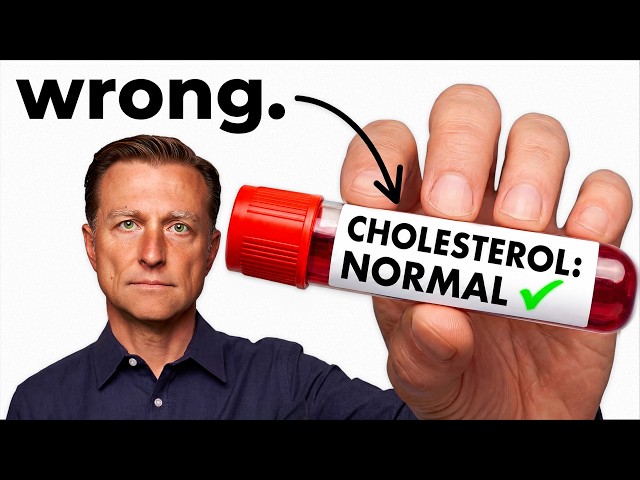 What is Normal Cholesterol (What Your Doctor Doesn’t Tell You)
