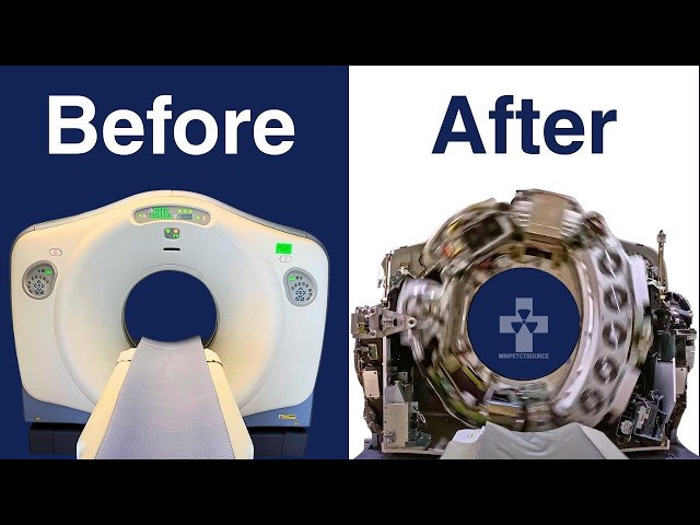 How Fast Does A CT Scan Machine Spin? World's Fastest CAT Scanner Spinning Max Speed