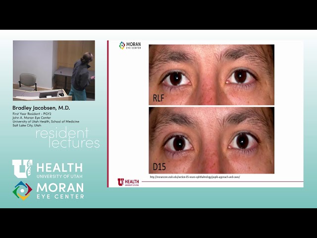 Pupil Anatomy and Cases [ARCHIVE]