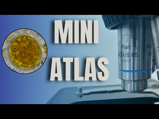 How to differentiate Entamoeba histolytica and E. hartmanni cysts + FREE Mini Atlas