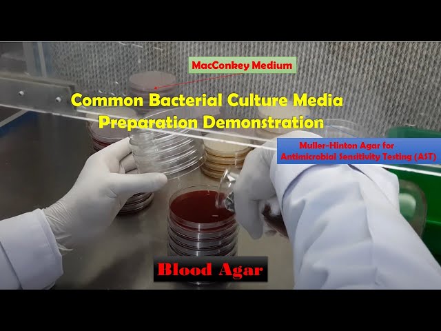 Macconkey, Blood and Muller-Hinton agar Preparation