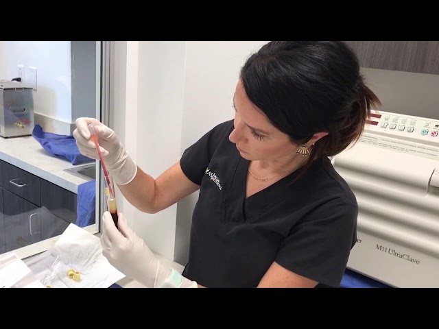 Platelet-Rich Plasma (PRP) Preparation