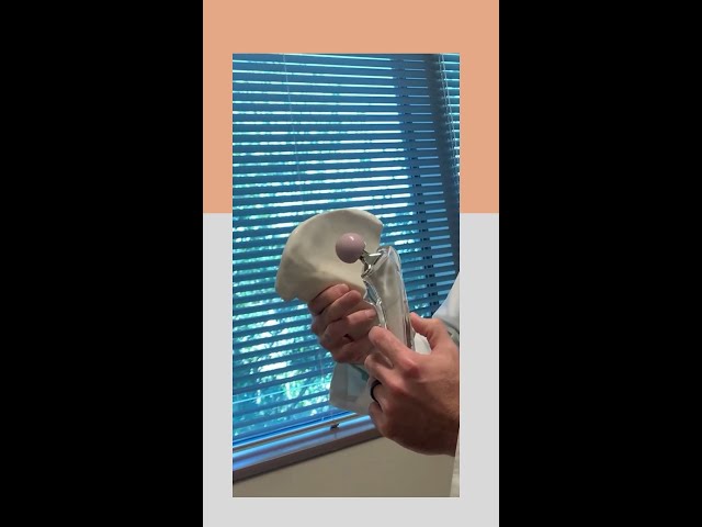 Dr. Cody Green Explains Hip Replacement Surgery