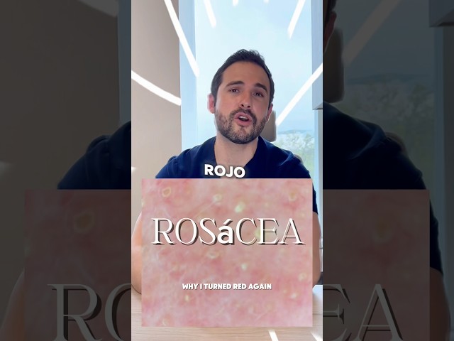 Why does rosacea flare up? #skincare #rosacea #skincare #dermatologistmonterrey #onderm #mty
