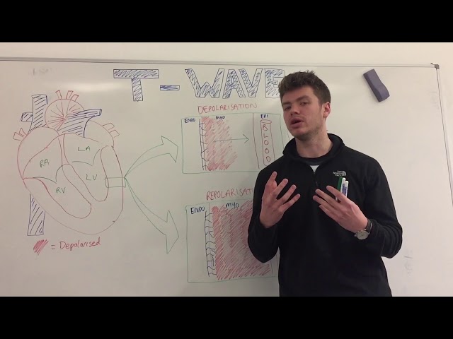 T Wave Explained