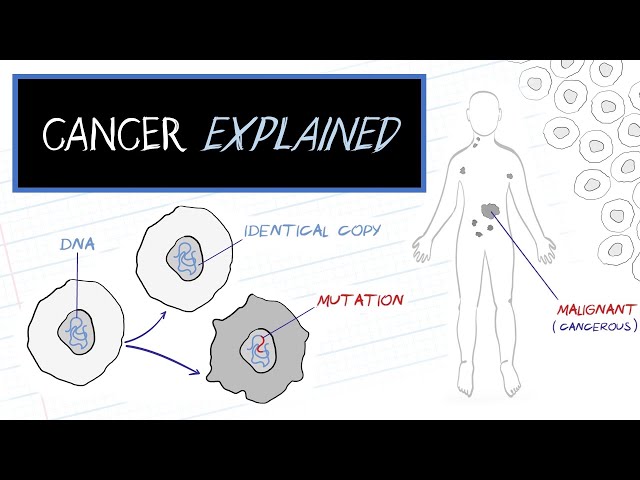 What is Cancer? (HealthSketch)