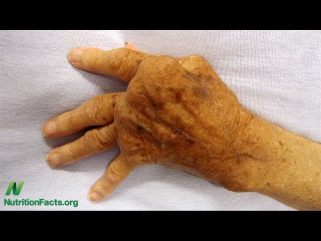 Potassium and Autoimmune Disease