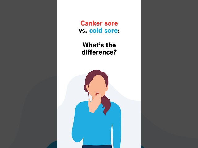 Canker sore vs cold sore: What's the difference?