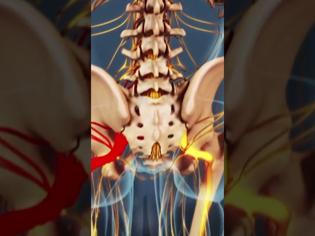 Visualization of Sciatica Symptoms