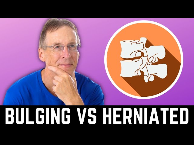 Exercises to Heal a Bulging Disc vs. Herniated Disc. The Difference?