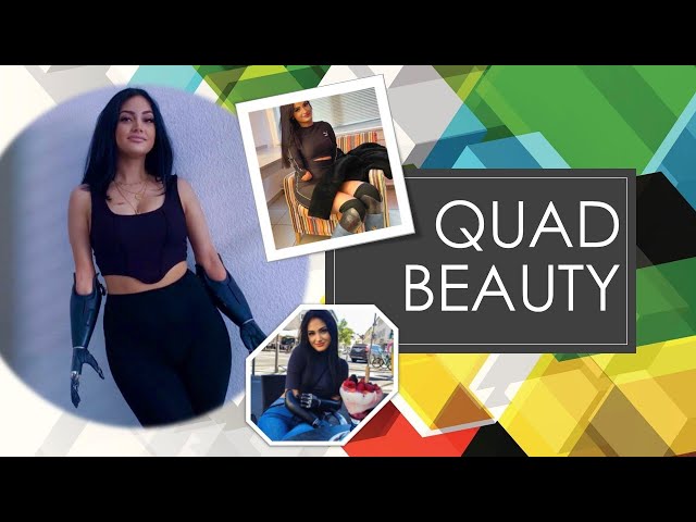 Quad amputee Beyza from Germany