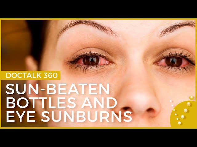 Doc Talk 360: Episode 3 | Sun Beaten Bottles and Eye Sunburns