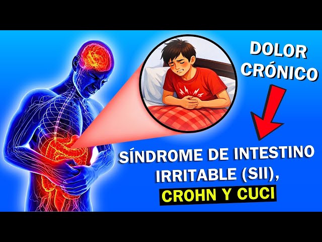 Irritable Bowel Syndrome | Differentiate it from Crohn's and Ulcerative Colitis