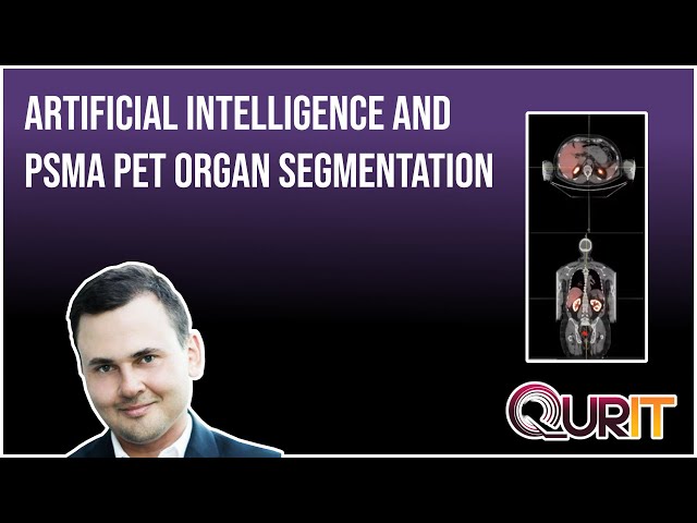 3-min semi automated PSMA PET organ segmentation method to use in clinic and train neural networks