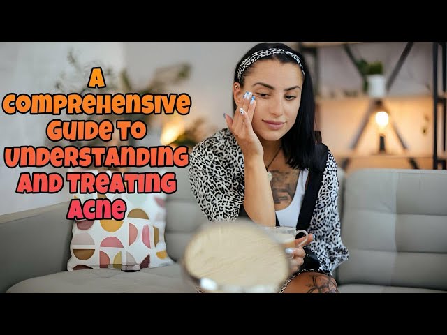 A Comprehensive Guide to Understanding and Treating Acne