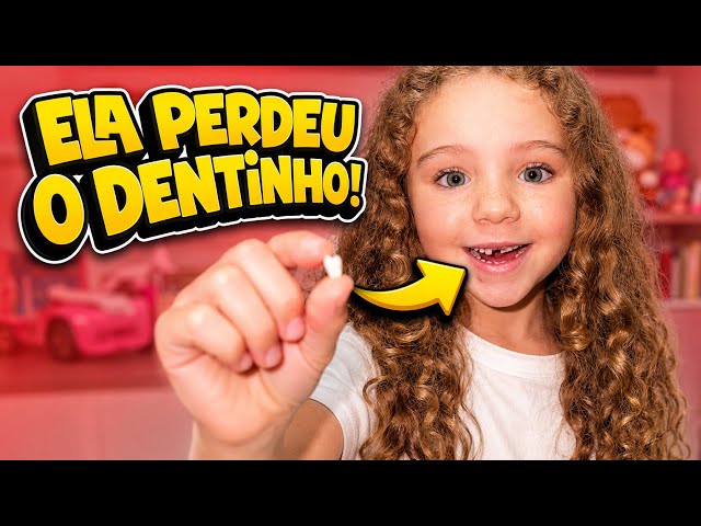DIVA PERDIÓ UN DIENTE | ella no quería que se lo sacaran